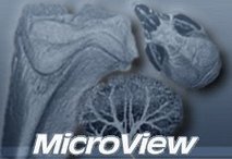 MicroView