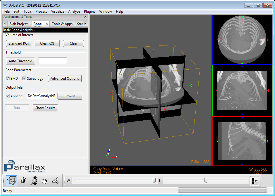 MicroView 2.5.0a10: Basic bone plugin, new image readers and a oblique-slice MIP tool added.