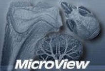 Extract the information you need from your image data with MicroView - the visualization and analysis platform for pre-clinical image data.
